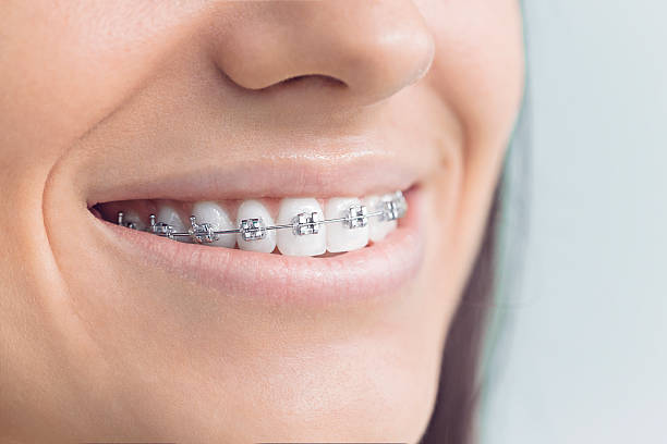 Best Full Mouth Reconstruction  in Summit, WA